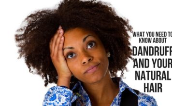 What You Need To Know About Dandruff and Your Natural Hair What You Need To Know About Dandruff and Your Natural Hair