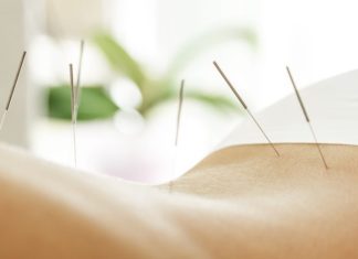 Acupuncture for Weight Loss: Does It Work? Acupuncture for Weight Loss: Does It Work?