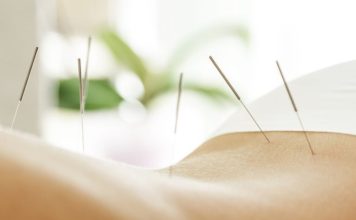 Acupuncture for Weight Loss: Does It Work?