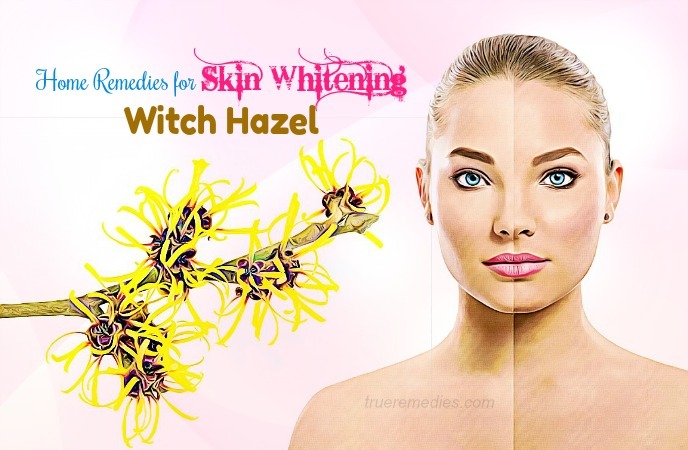 home-remedies-for-skin-whitening-witch-hazel