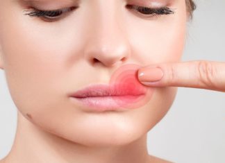 How to Get Rid of a Cold Sore—and Prevent It From Coming Back How to Get Rid of a Cold Sore—and Prevent It From Coming Back