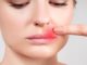 How to Get Rid of a Cold Sore—and Prevent It From Coming Back